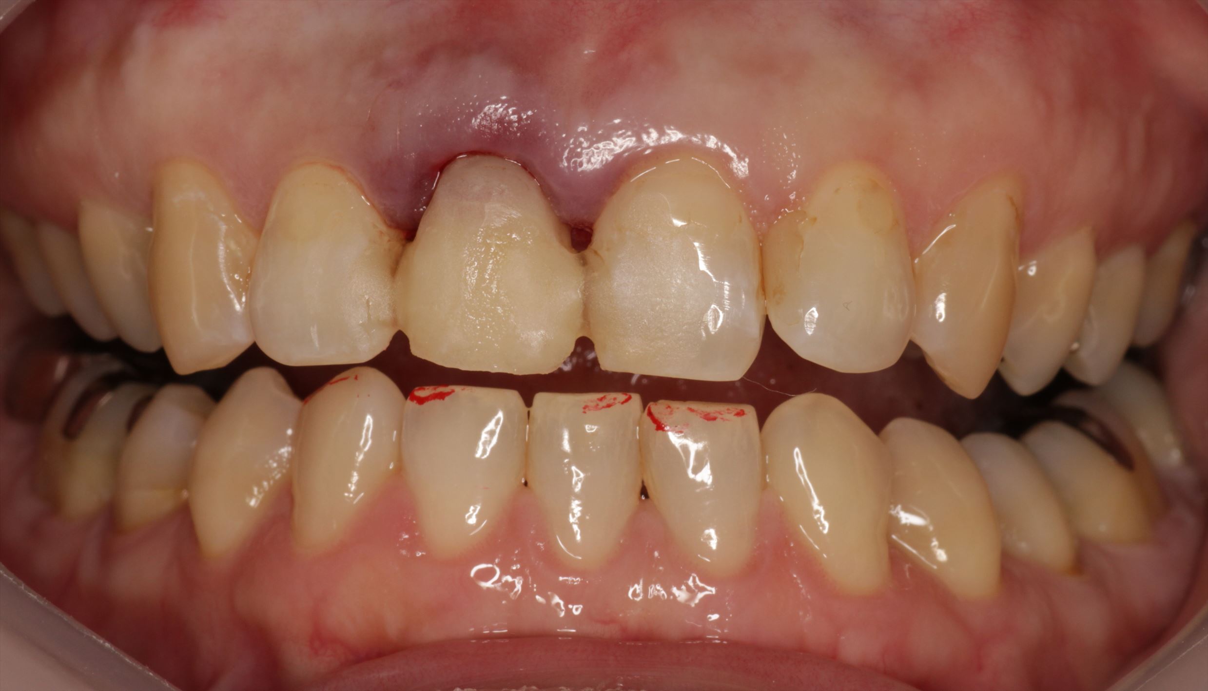 治療経過や症例の詳細紹介