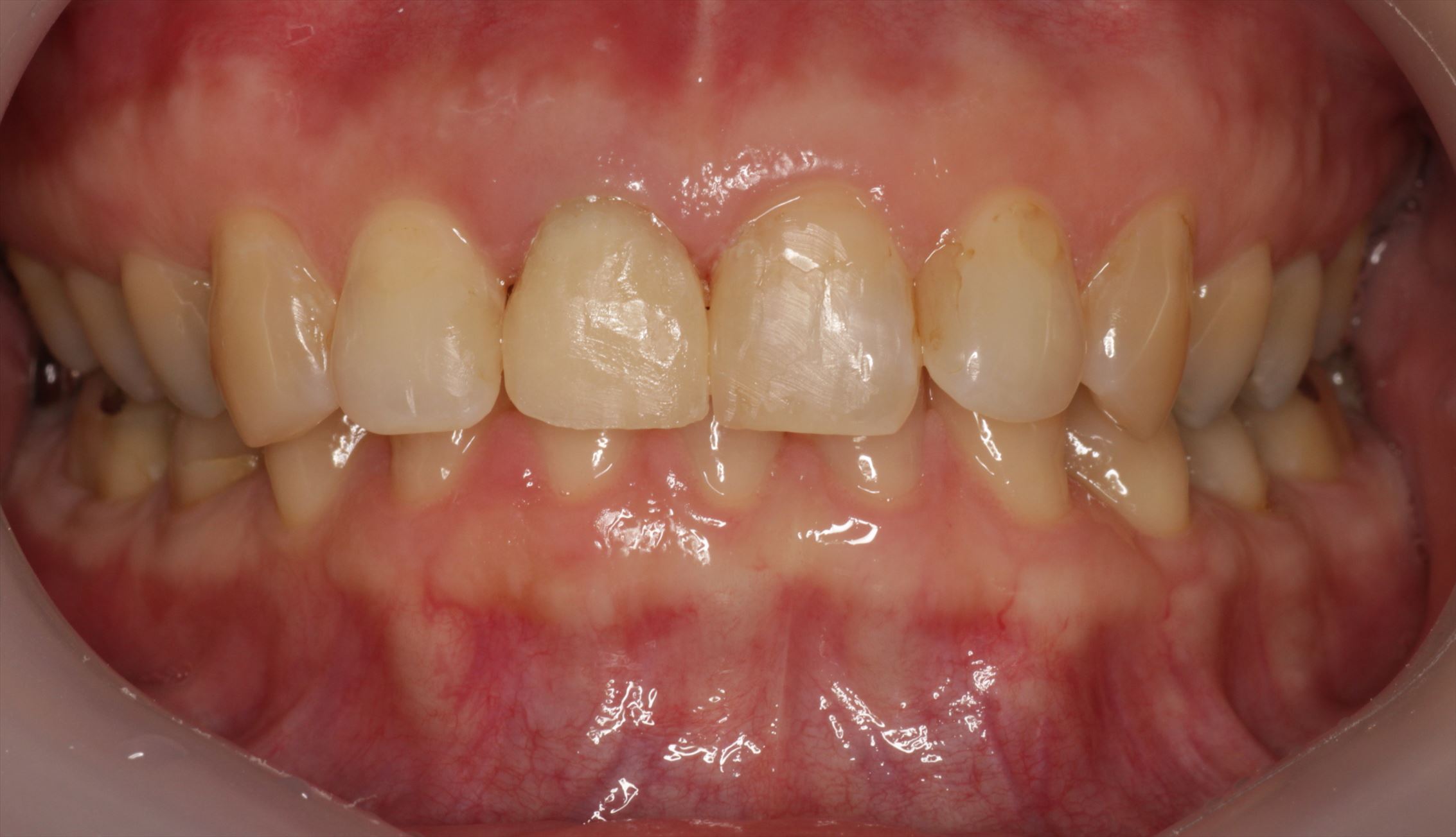 治療経過や症例の詳細紹介