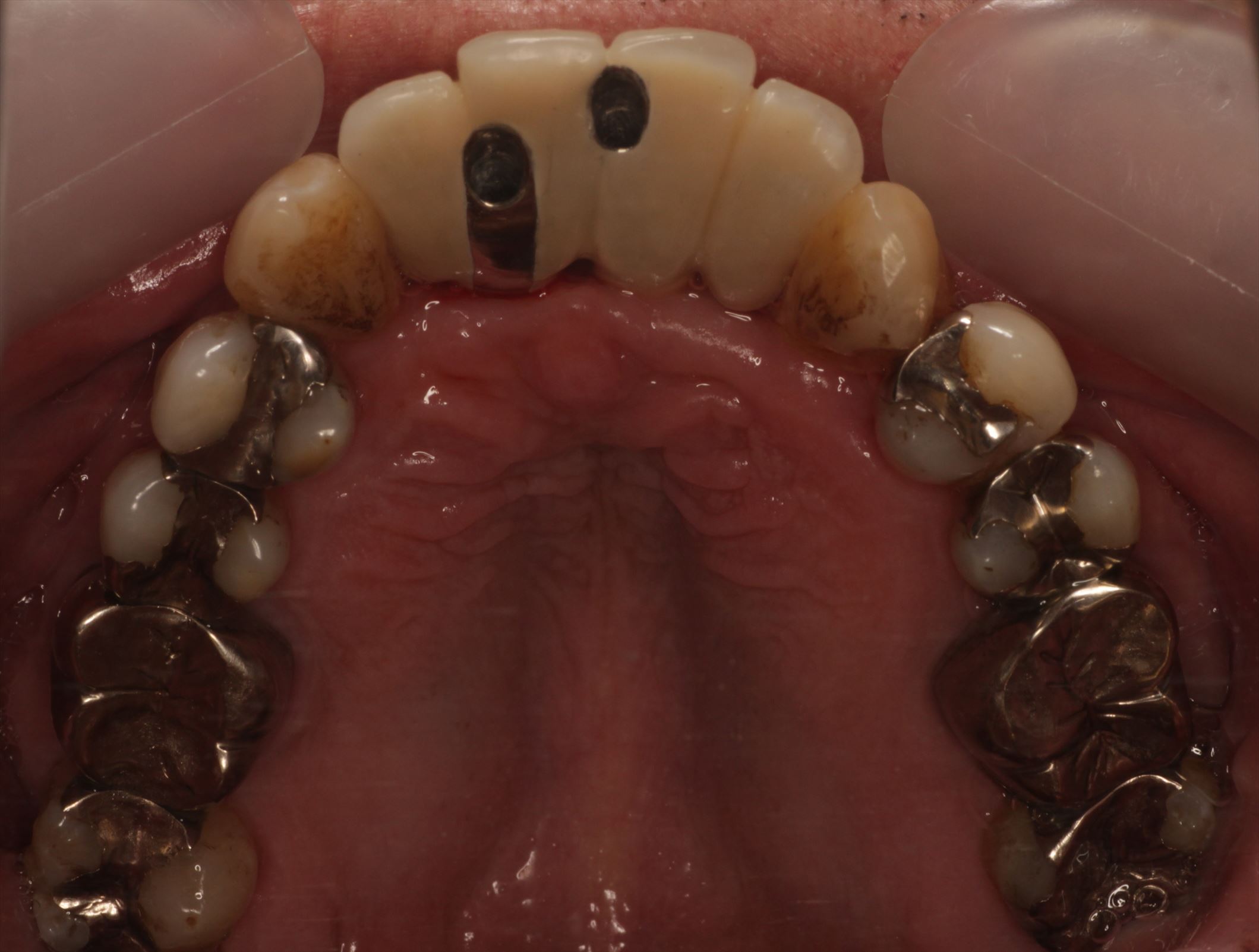 治療経過や症例の詳細紹介
