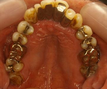 治療経過や症例の詳細紹介