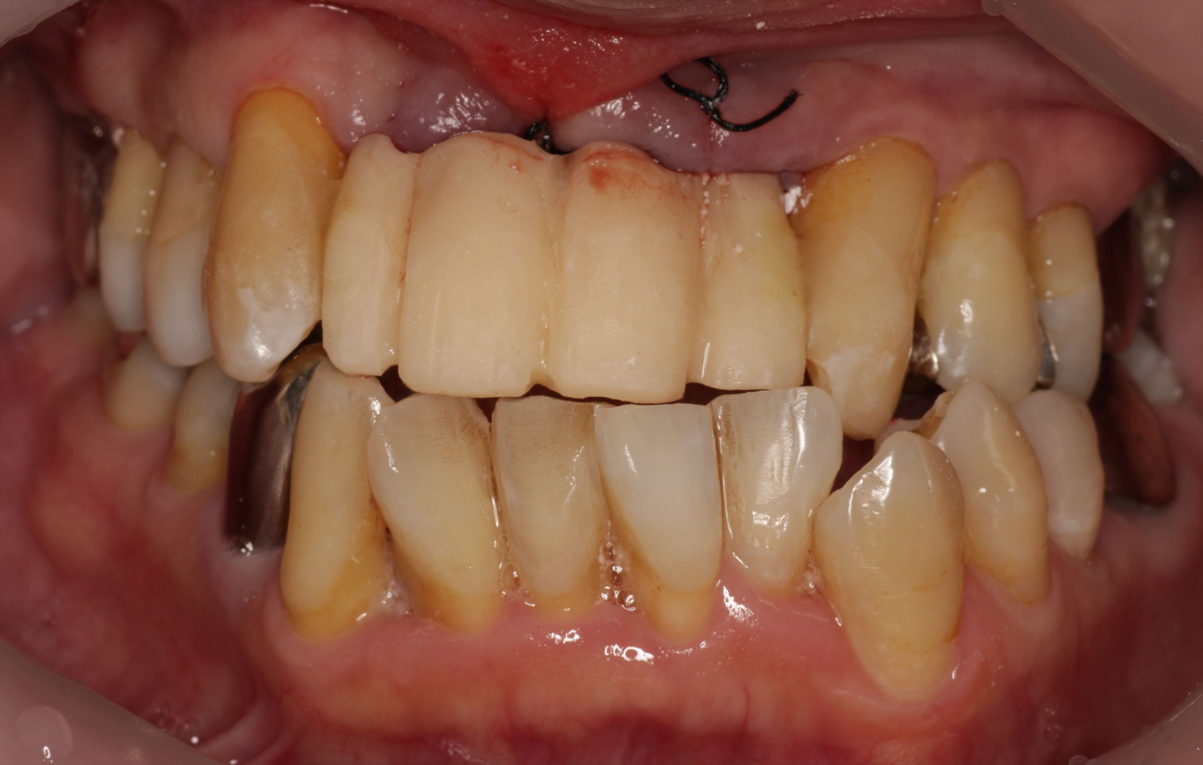 治療経過や症例の詳細紹介