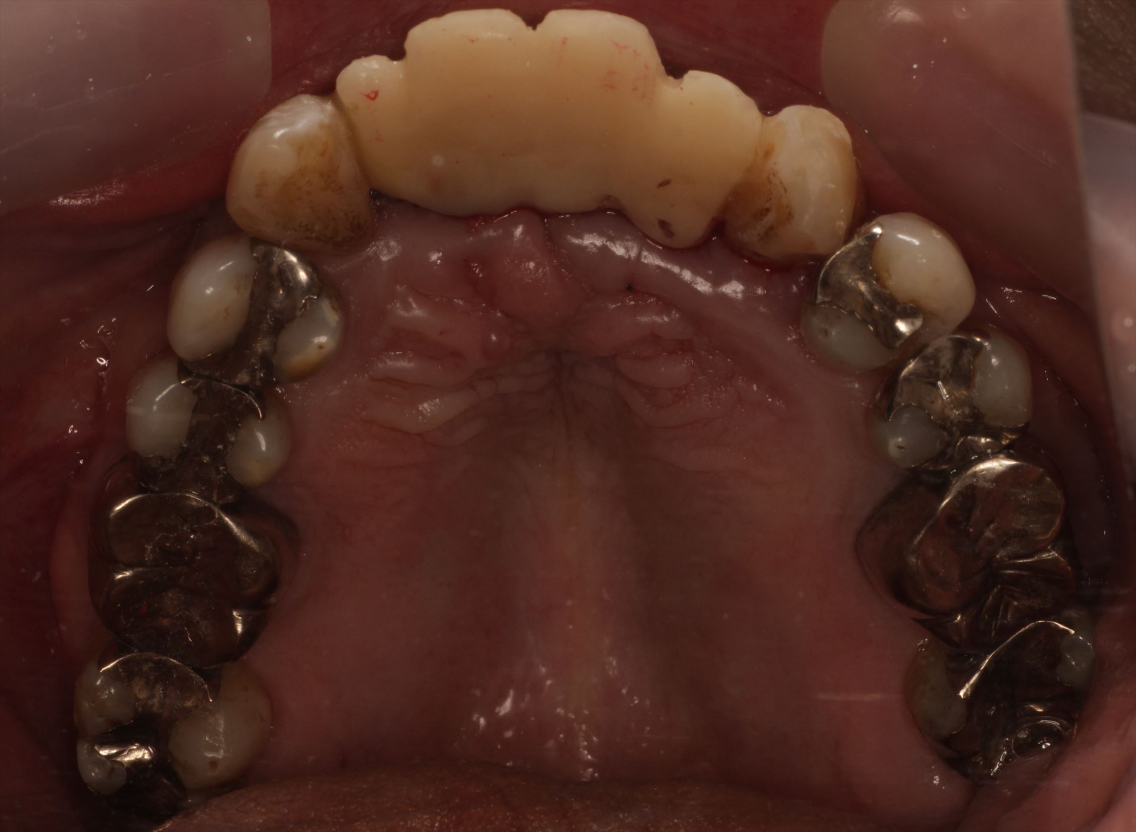 治療経過や症例の詳細紹介
