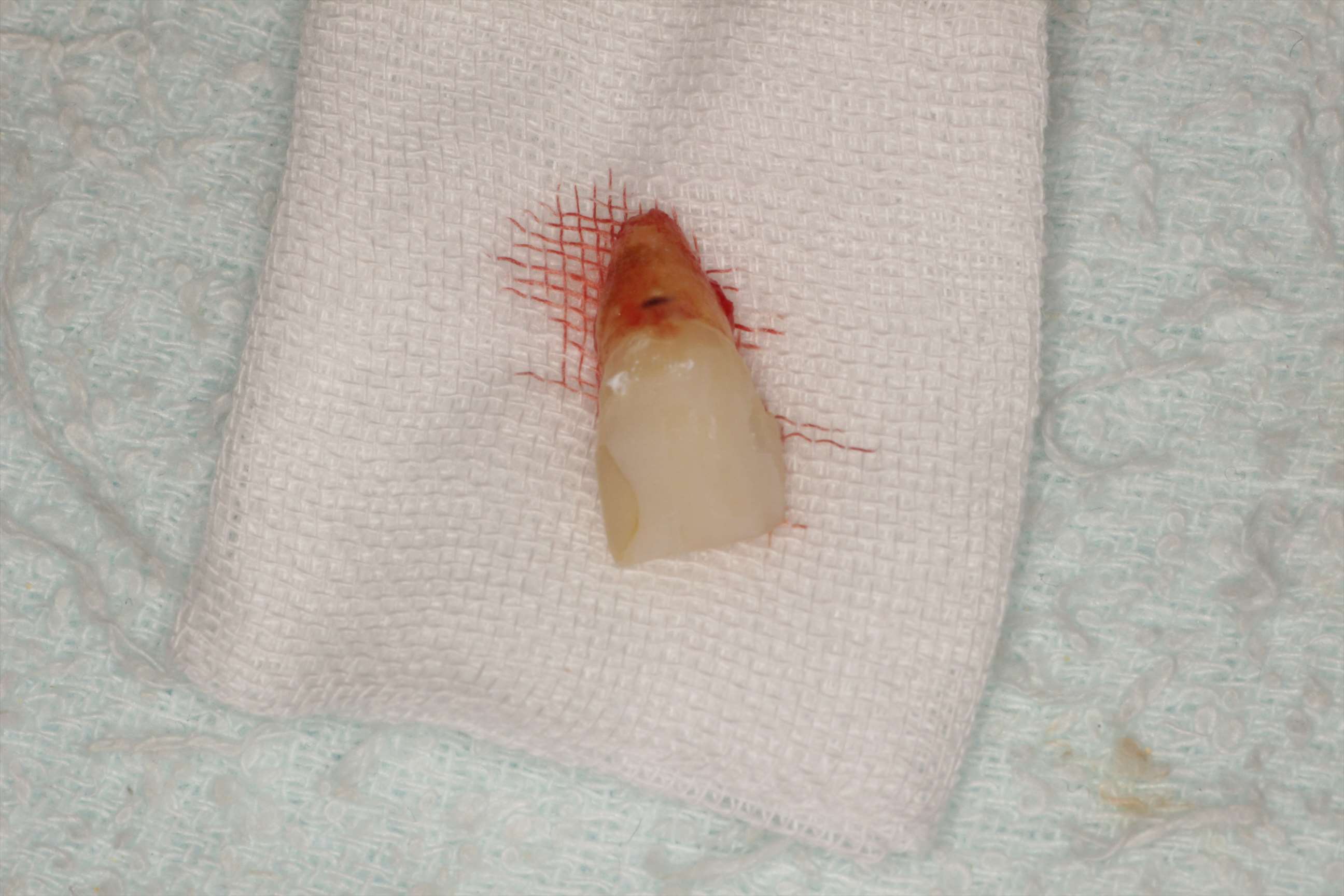 治療経過や症例の詳細紹介