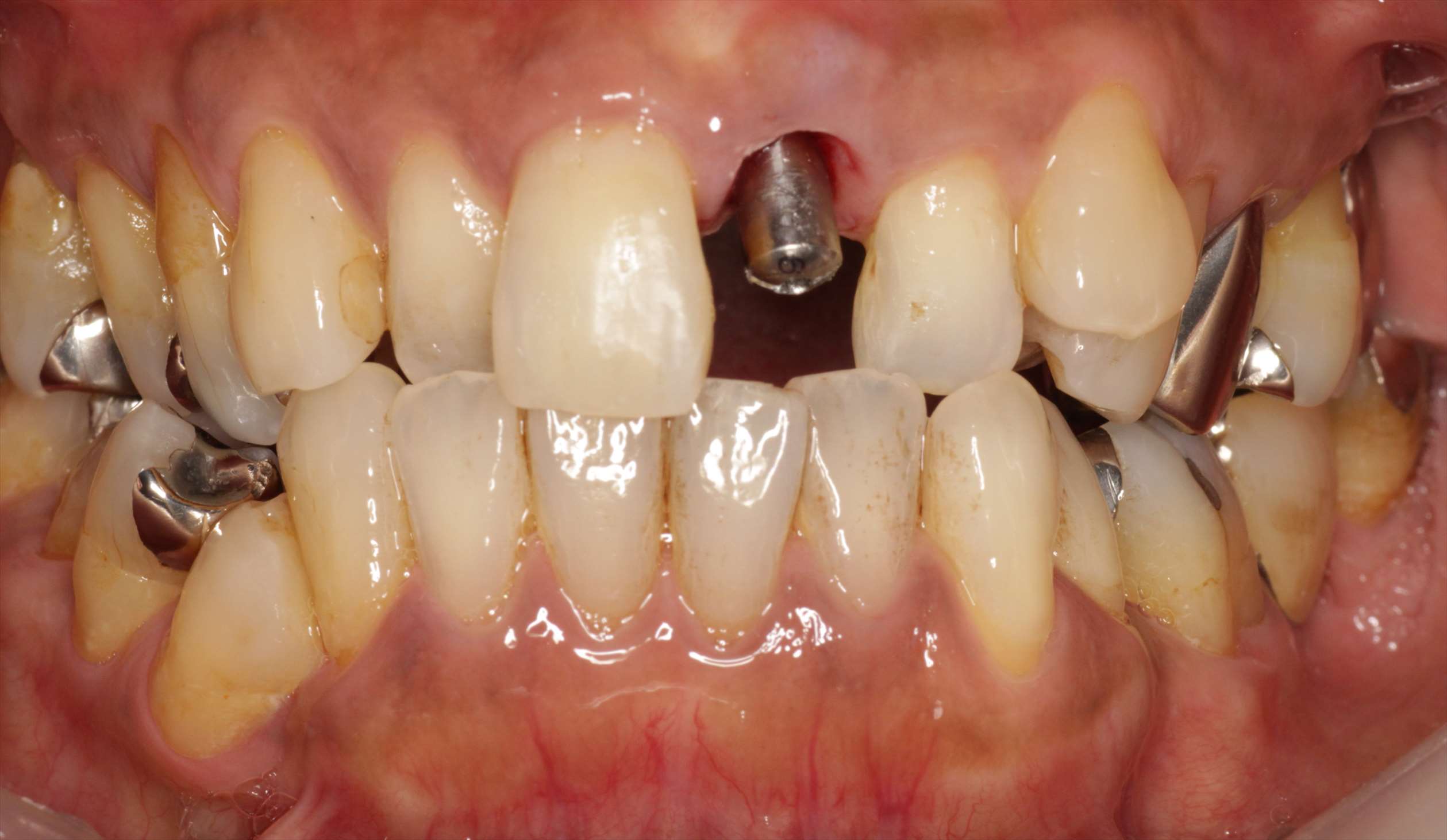 治療経過や症例の詳細紹介