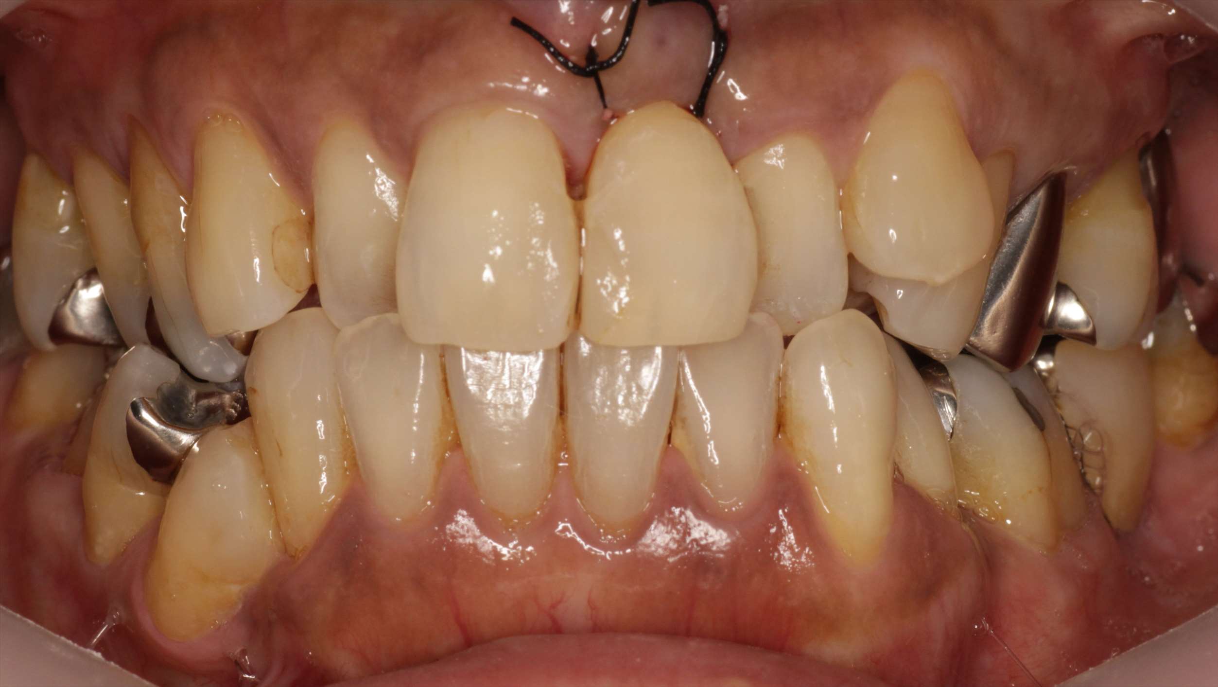 治療経過や症例の詳細紹介