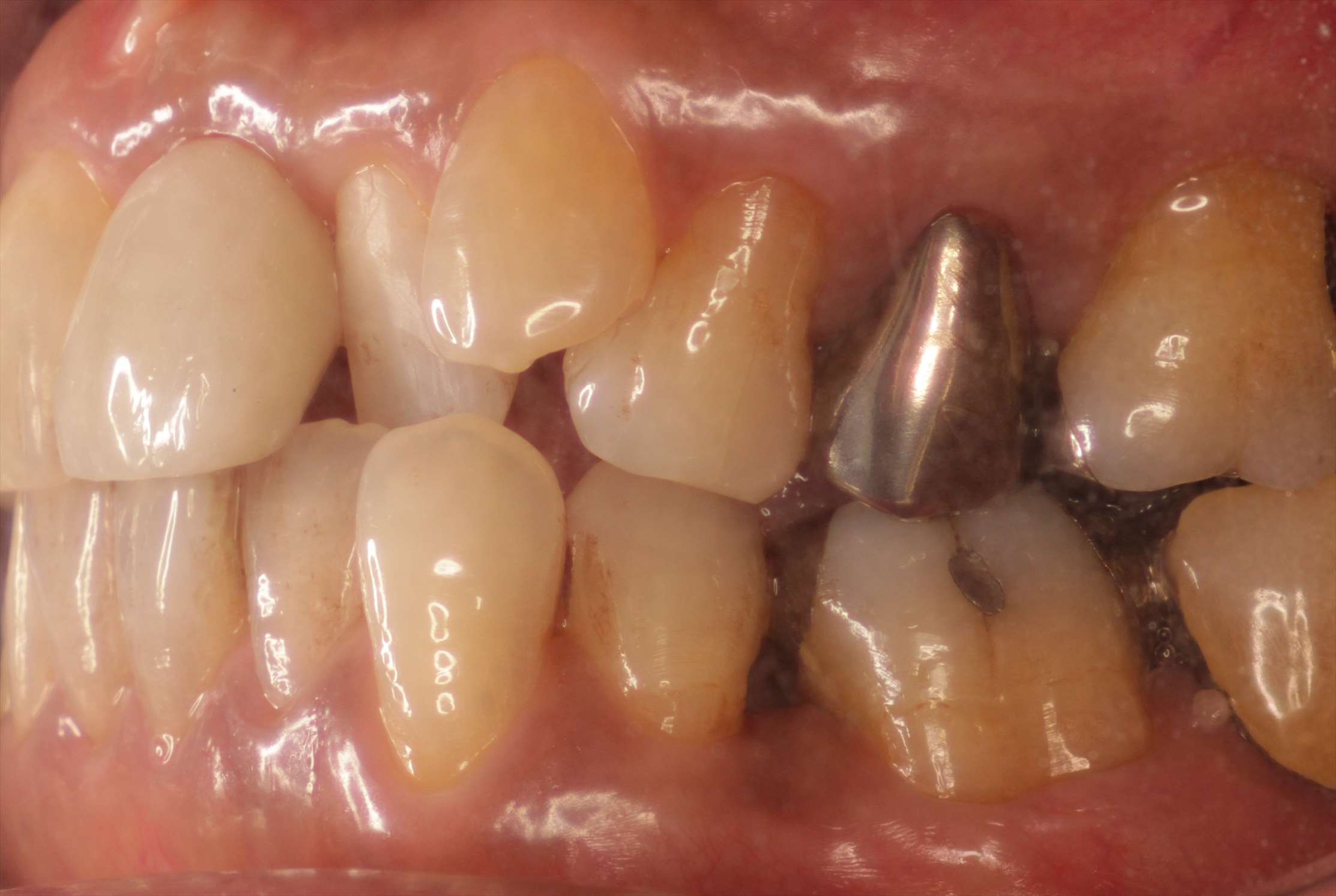 治療経過や症例の詳細紹介