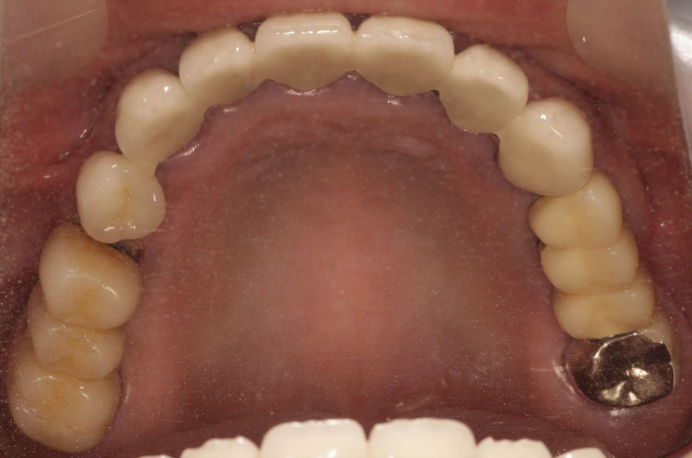 治療経過や症例の詳細紹介