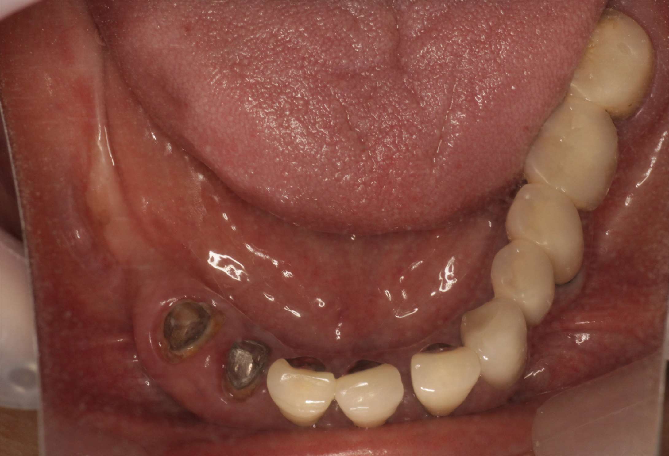 治療経過や症例の詳細紹介