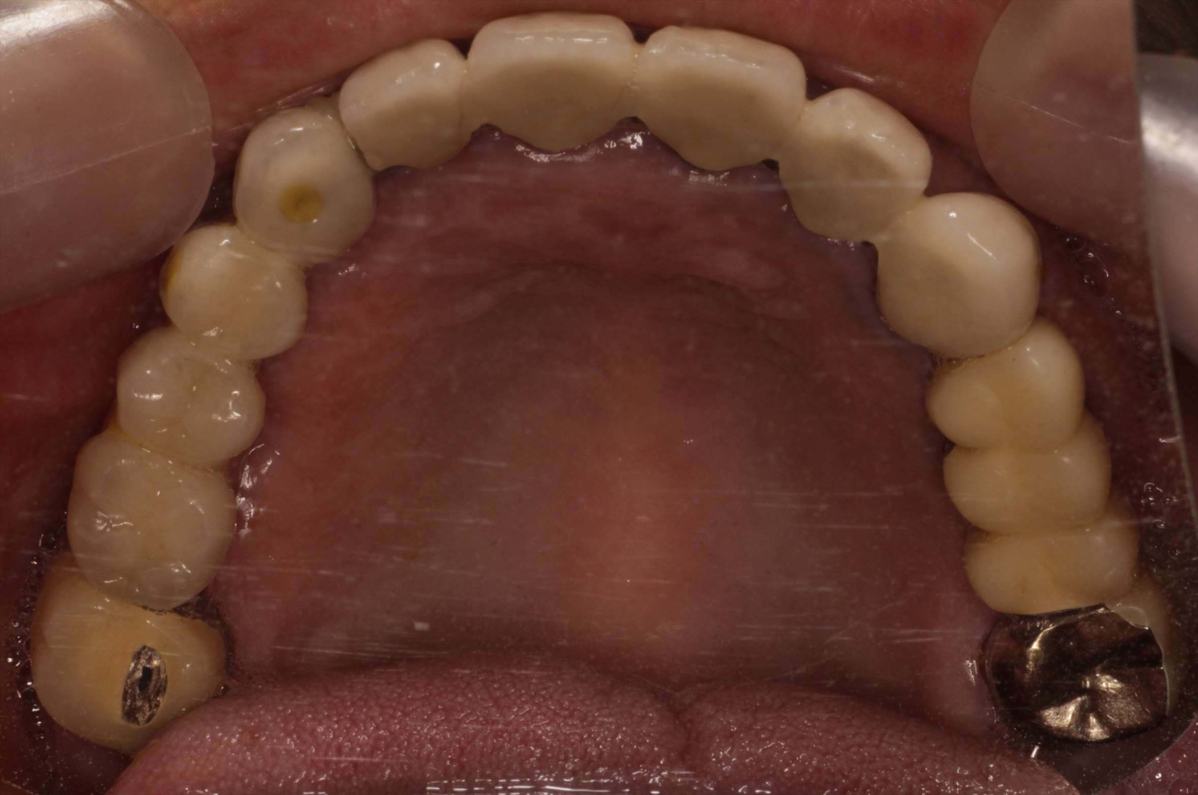 治療経過や症例の詳細紹介