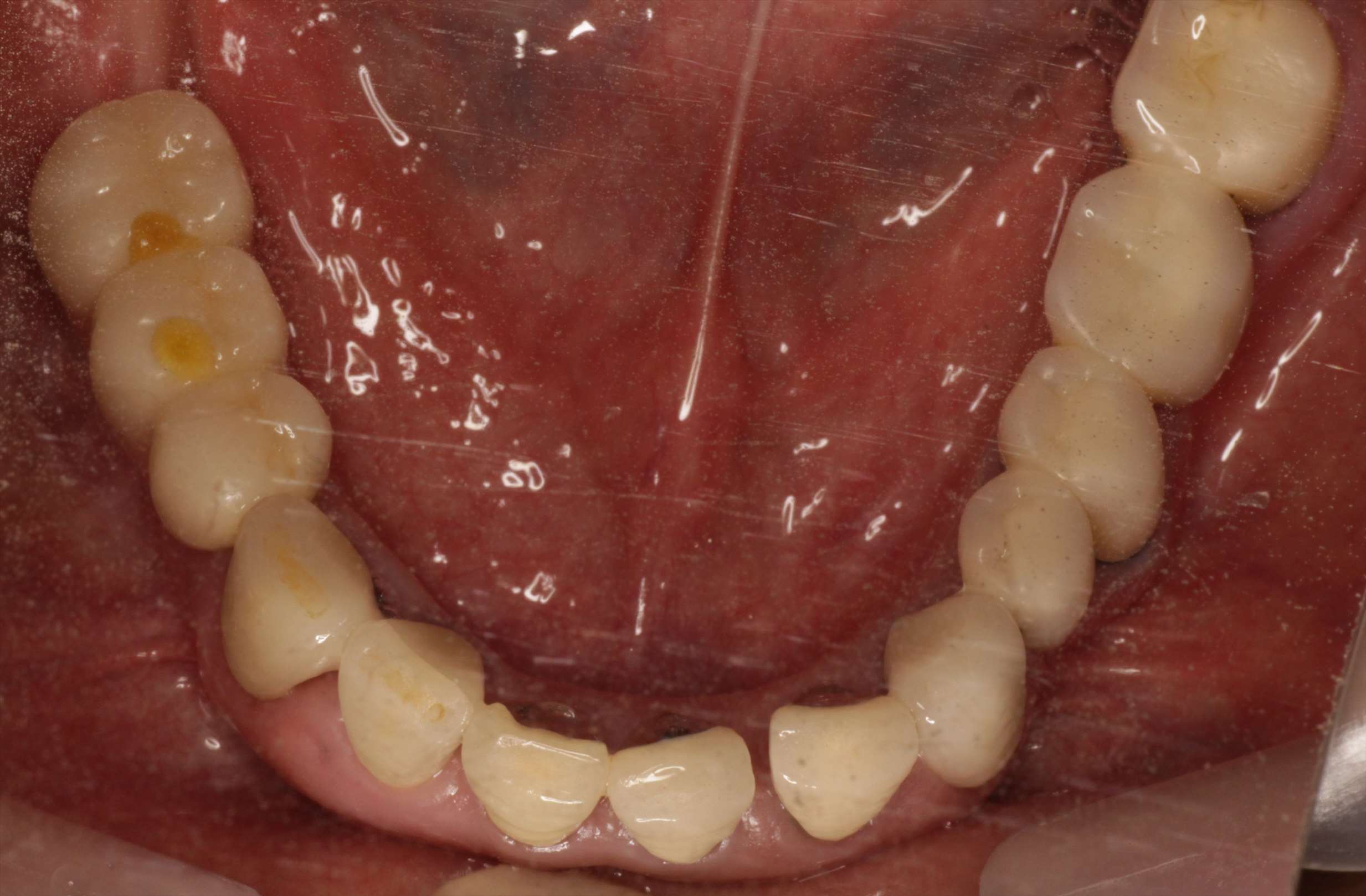 治療経過や症例の詳細紹介