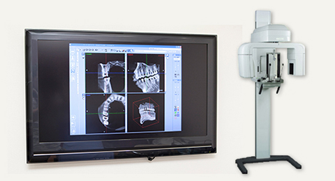 インプラント治療を行う前の精密な検査