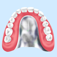 インプラントオーバーデンチャーほかさまざまな入れ歯にも対応